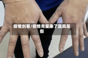 疫情剑客/疫情克星来了是真是假