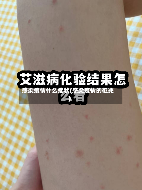 感染疫情什么症状(感染疫情的征兆)-第3张图片